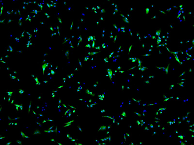 技术参数 正文细胞名称:mda-mb-231/gfp(人乳腺癌细胞(绿色荧光蛋白