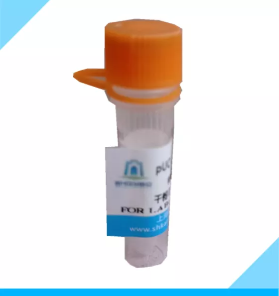 pCDNA3.1-HA-TBK1